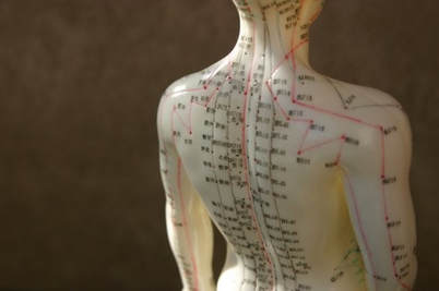 acupuncture, chinese medicine